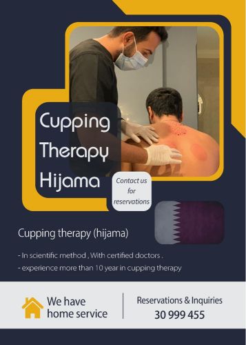 cupping therapy 